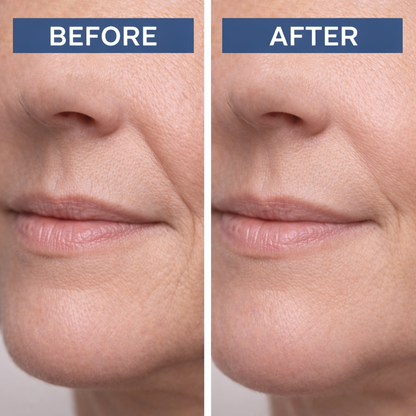 Noluxe® Hyaluronic Acid